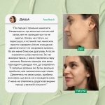 Lamic Сироватка для обличчя з проявами акне, 50 мл