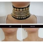 My Neck - антивікова маска для шиї